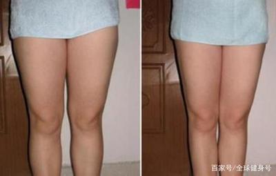 大象腿怎样快速的瘦腿