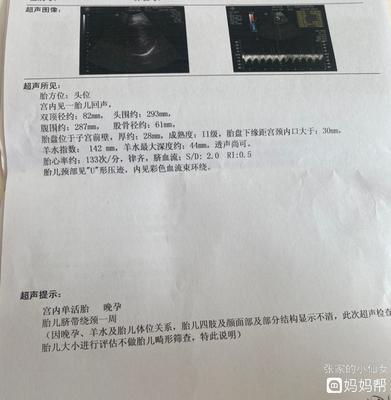 胎儿32周脐带绕颈一周怎么办