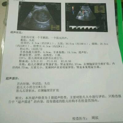 怀孕7个半月是多少周