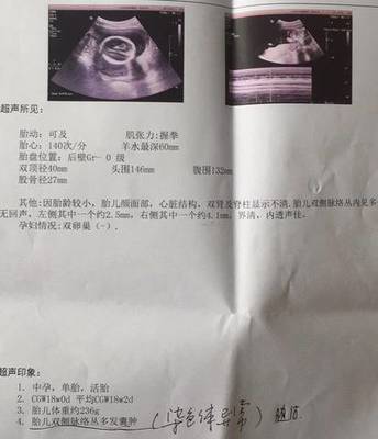18周胎儿真实图