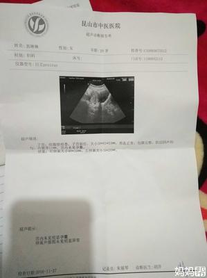 过几天能查出是否怀孕