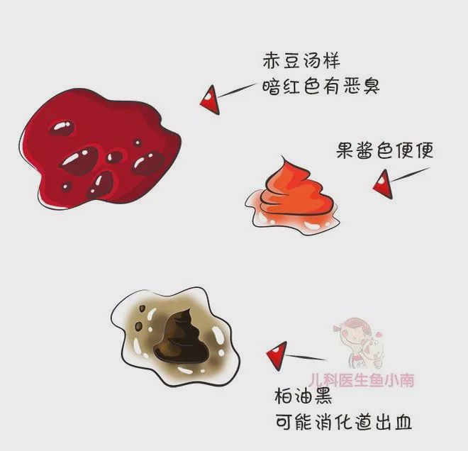 宝宝大便恶臭怎么回事
