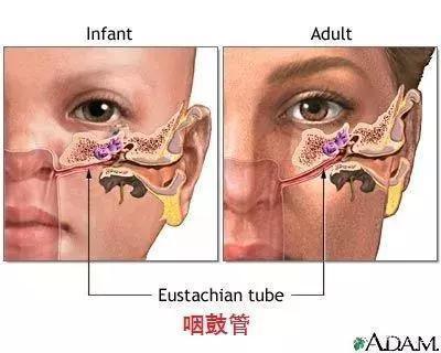 三岁宝宝中耳炎