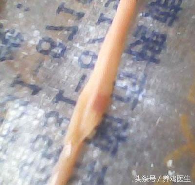 鼻腔溃疡怎么治疗