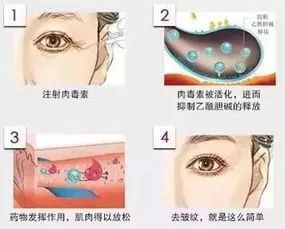 除皱原理