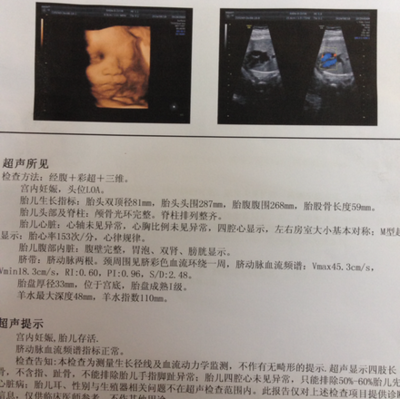 32周胎宝宝