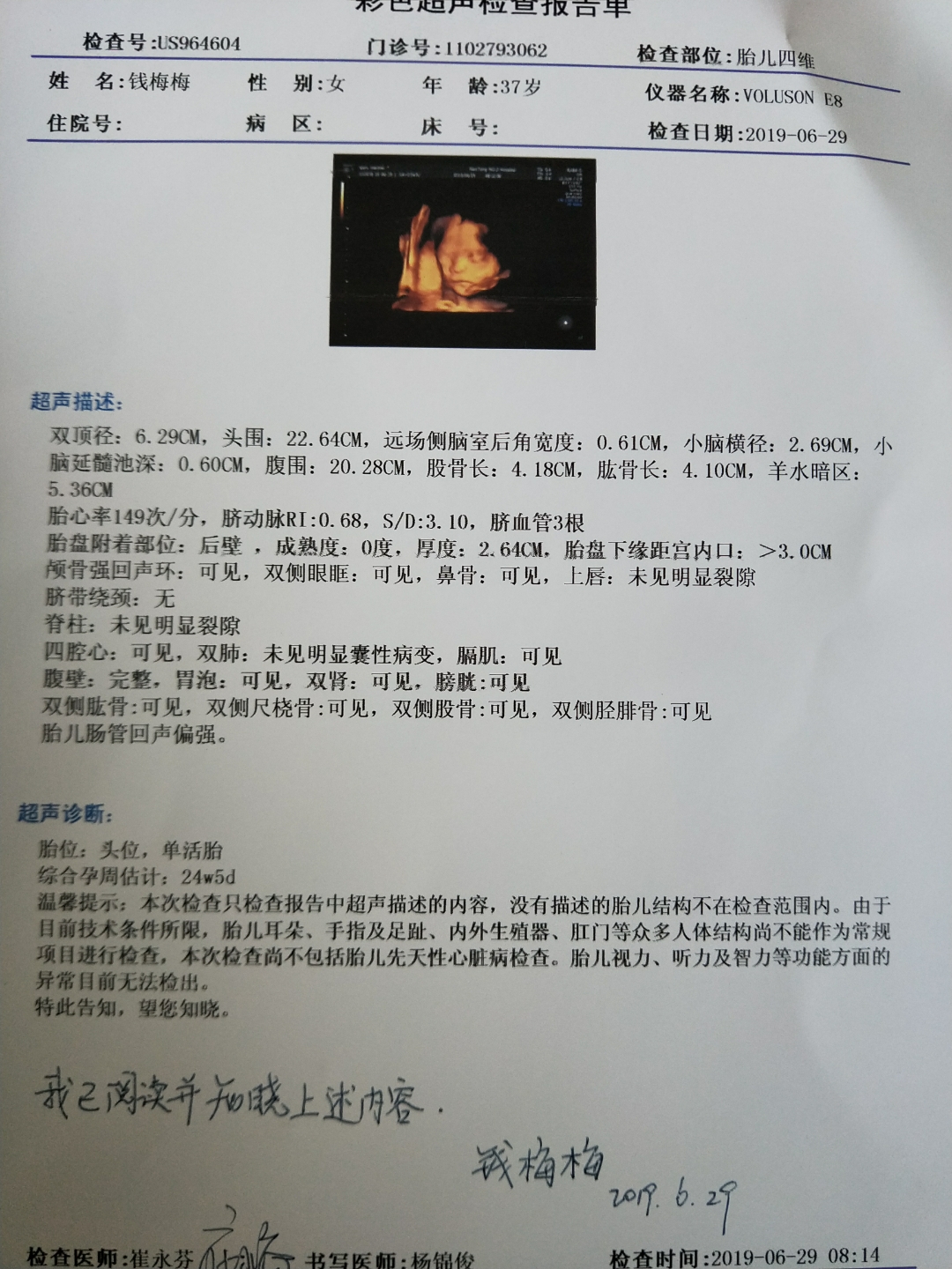 十七周的胎儿彩超图