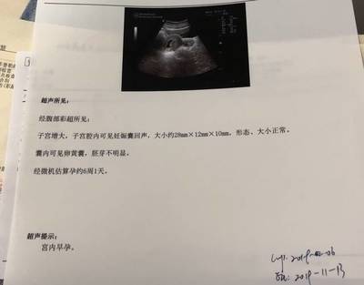怀孕五周孕吐正常吗