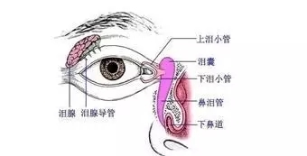 新生儿泪道堵塞的症状