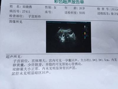 怀孕50天做什么检查