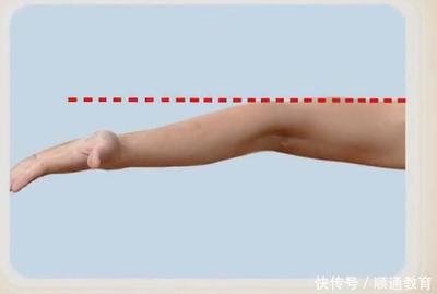 胳膊小臂疼是怎么回事