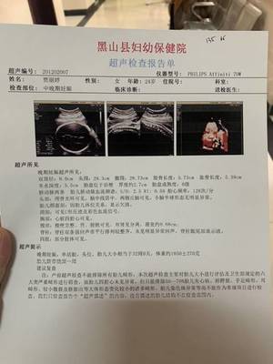 怀孕30周真实胎儿图片