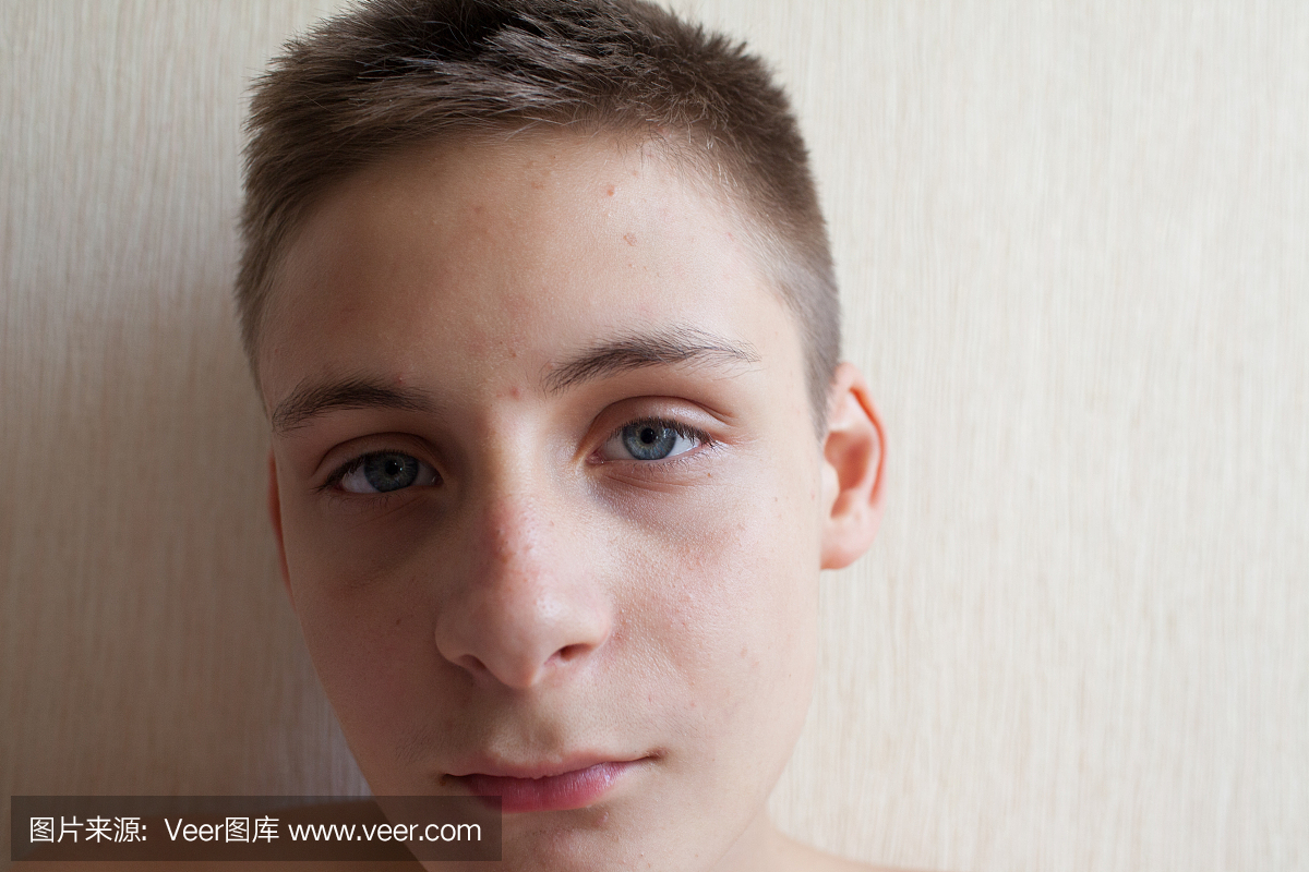 男孩青春期起痘痘
