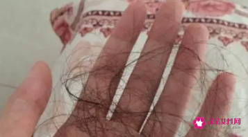 梦见自己掉头发秃顶了
