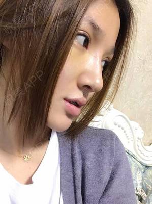 割了双眼皮能看手机吗