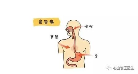 偶尔食道疼是怎么回事
