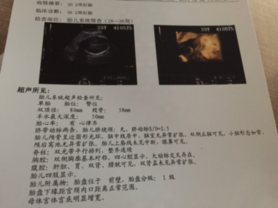 30周胎儿图片