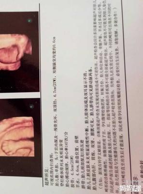 脑子有积液是怎么回事
