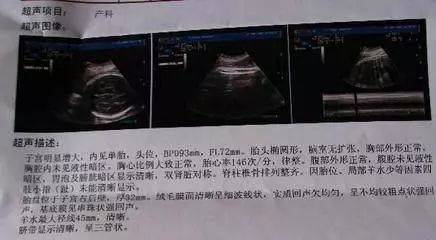 听诊器对胎儿有影响吗