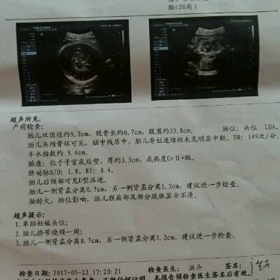 二十周的胎儿有多大