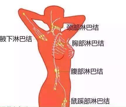 颈部淋巴结核怎么治疗