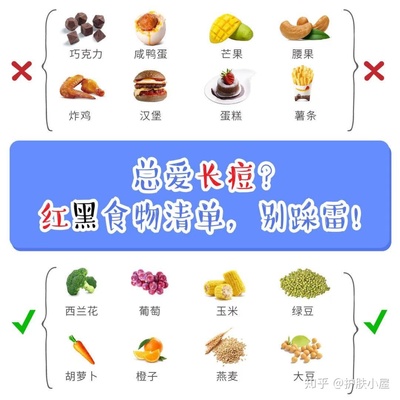 长痘痘应该忌口什么