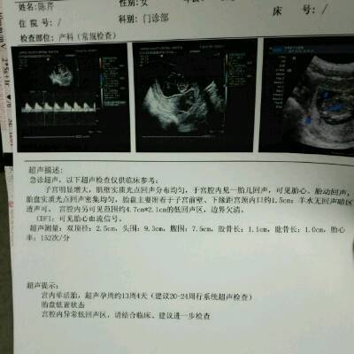 怀孕14周宝宝有多大