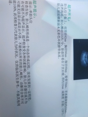 胎儿多少斤正常