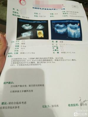 宫腔粘连怀孕怎么办