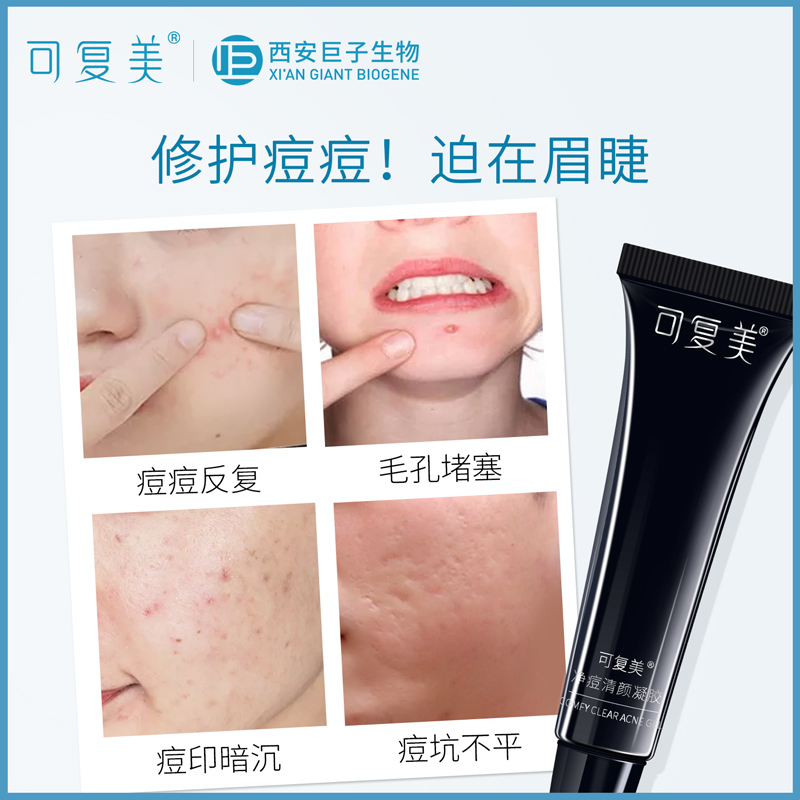 痘痘肌肤用什么牌子最好