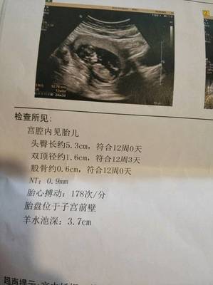 12周胎儿nt值正常范围