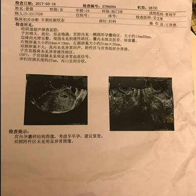 拍片子多久可以怀孕