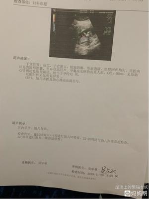 怀孕出血量