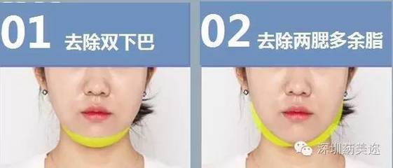 两腮肿胀是怎么回事