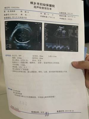 一个月双顶径能长多少