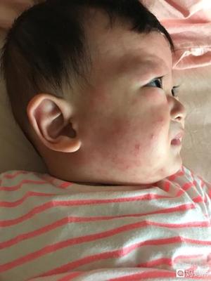 宝宝高烧一般持续几天