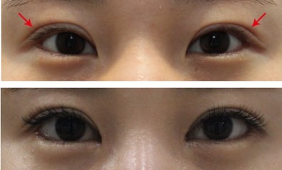 眼角老流泪是怎么回事