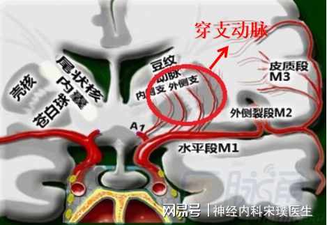 腔隙灶怎么治疗