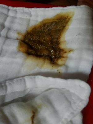 宝宝的便便有酸臭味