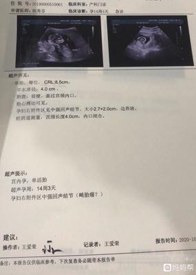 孕妇胎盘低是什么原因