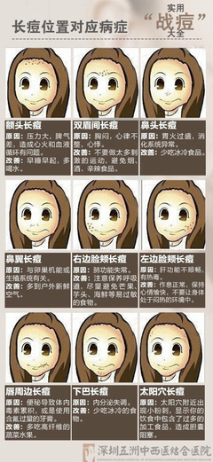 眉间粉刺是什么原因