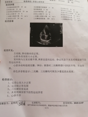 胎儿蜷缩成一团彩超图