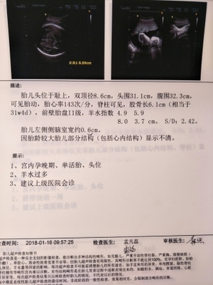 35周胎儿图片