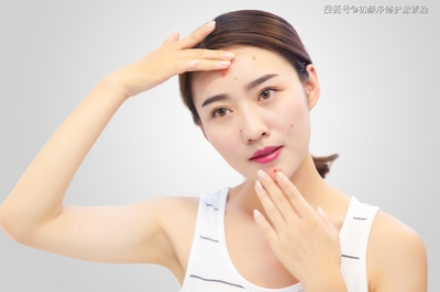 女士治愈痘痘小窍门