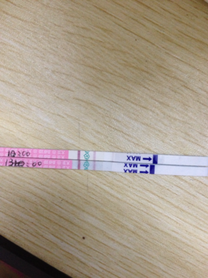 排卵期咖啡色白带