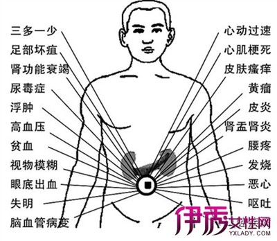左边肾部位疼痛是怎么回事