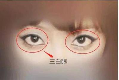 白眼珠多的人什么命