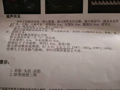 胎儿绕颈三周