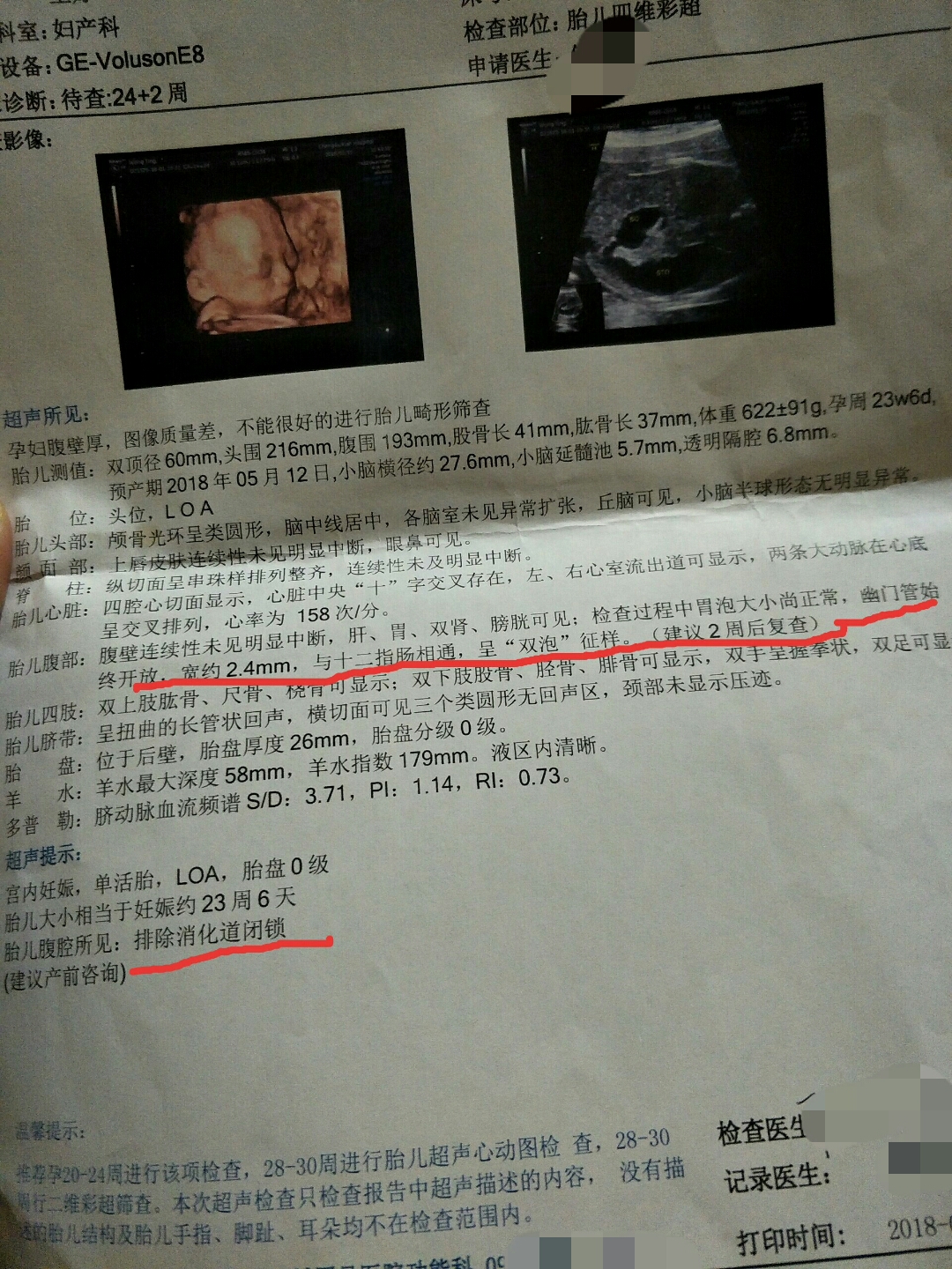 怀孕24周胎儿发育标准