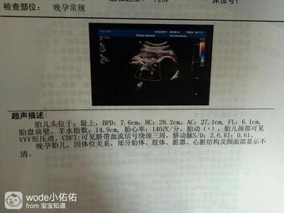 胎儿绕颈三周